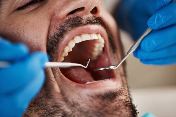 Best Emergency Treatment for Dental Infections or Abscesses in East Harwich, MA